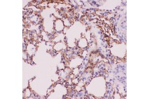Image no. 5 for anti-Angiotensin I Converting Enzyme (Peptidyl-Dipeptidase A) 1 (ACE) (AA 651-864) antibody (ABIN3043777)