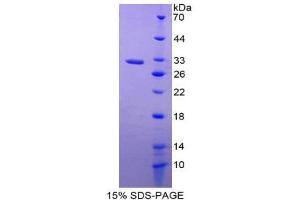 Image no. 1 for Prostaglandin-Endoperoxide Synthase 1 (Prostaglandin G/H Synthase and Cyclooxygenase) (PTGS1) (AA 367-599) protein (His tag) (ABIN1878775)