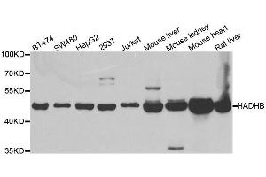 Image no. 1 for anti-Hydroxyacyl-CoA Dehydrogenase/3-Ketoacyl-CoA Thiolase/enoyl-CoA Hydratase (Trifunctional Protein), beta Subunit (HADHB) antibody (ABIN6141589)