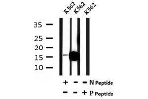Image no. 4 for anti-Vesicle-Associated Membrane Protein 4 (VAMP4) (pSer88) antibody (ABIN6269707)