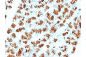 Elastase 3B antibody  (AA 82-238)