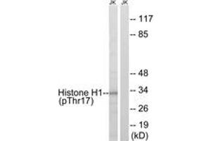 Western blot analysis of extracts from Jurkat cells treated with UV 15', using Histone H1 (Phospho-Thr17) Antibody.