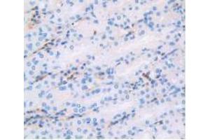 Immunohistochemistry (Paraffin-embedded Sections) (IHC (p)) image for Rabbit anti-Human IgG4 (AA 222-327) antibody (ABIN2862700)