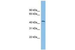 Image no. 1 for anti-DPH1 Homolog (DPH1) (AA 35-84) antibody (ABIN6744924)