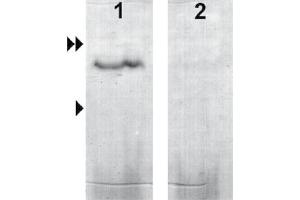 Image no. 2 for anti-Guanylate Cyclase Activator 2B (Uroguanylin) (GUCA2B) antibody (ABIN870783)