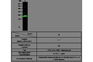 Image no. 2 for anti-Carbonic Anhydrase II (CA2) (AA 1-260) antibody (ABIN1996917)