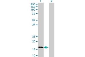 Image no. 1 for anti-Mitochondrial Ribosomal Protein L50 (MRPL50) (AA 1-158) antibody (ABIN527106)