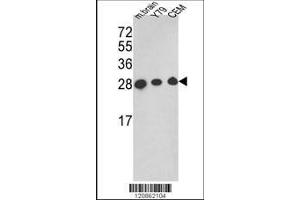 Image no. 1 for anti-Triosephosphate Isomerase 1 (TPI1) (AA 258-286), (C-Term) antibody (ABIN389458)