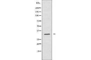 Image no. 1 for anti-Solute Carrier Family 25 (Mitochondrial Carrier, Adenine Nucleotide Translocator), Member 6 (SLC25A6) antibody (ABIN6258663)