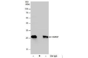 Image no. 3 for anti-Heat Shock 27kDa Protein 1 (HSPB1) (Center) antibody (ABIN2854951)