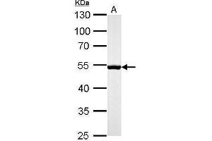 Image no. 6 for anti-Desmin (DES) (Center) antibody (ABIN2855655)