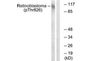 Image no. 1 for anti-Retinoblastoma Protein (Rb Protein) (AA 601-650), (pThr826) antibody (ABIN1531625)