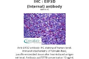 Image no. 1 for anti-Eukaryotic Translation Initiation Factor 3, Subunit D (EIF3D) (Internal Region) antibody (ABIN1733943)