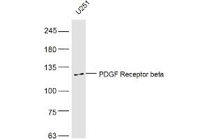 U251 lysates probed with PDGF Receptor beta Polyclonal Antibody, Unconjugated  at 1:500 dilution and 4˚C overnight incubation.