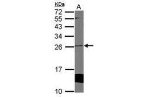 Image no. 1 for anti-Cytoglobin (CYGB) (AA 1-190) antibody (ABIN1501883)