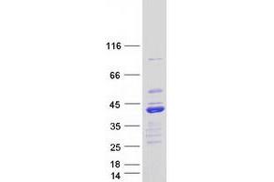 Image no. 1 for BCL2-Like 14 (Apoptosis Facilitator) (BCL2L14) (Transcript Variant 4) protein (Myc-DYKDDDDK Tag) (ABIN2715197)