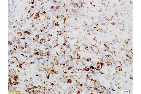 PRAME antibody  (AA 151-250)