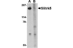 Image no. 1 for anti-SLIT and NTRK-Like Family, Member 5 (SLITRK5) (Middle Region 2) antibody (ABIN1031202)