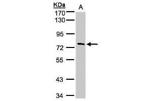 Image no. 2 for anti-Tetratricopeptide Repeat Domain 30A (TTC30A) (Center) antibody (ABIN2856506)