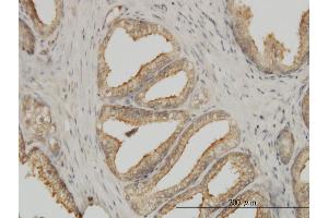 Image no. 3 for anti-Tubulin, alpha 1B (TUBA1B) (AA 1-451) antibody (ABIN564507)