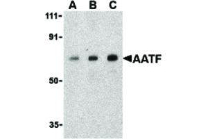 Image no. 1 for anti-Apoptosis Antagonizing Transcription Factor (AATF) (C-Term) antibody (ABIN6655674)