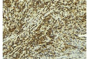 Image no. 2 for anti-Mitogen-Activated Protein Kinase Associated Protein 1 (MAPKAP1) (C-Term) antibody (ABIN6265084)