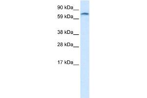 Image no. 2 for anti-Zinc Finger Protein 84 (ZNF84) (C-Term) antibody (ABIN2776393)
