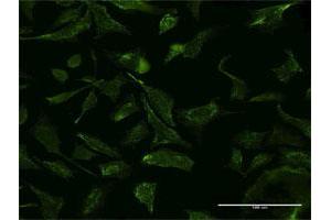 Image no. 4 for anti-Valosin Containing Protein (VCP) (AA 1-110) antibody (ABIN521311)