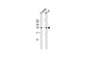 Image no. 1 for anti-Interleukin 25 (IL25) (AA 76-104) antibody (ABIN5531471)