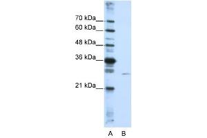 Image no. 2 for anti-EMG1 Nucleolar Protein Homolog (EMG1) antibody (ABIN633419)