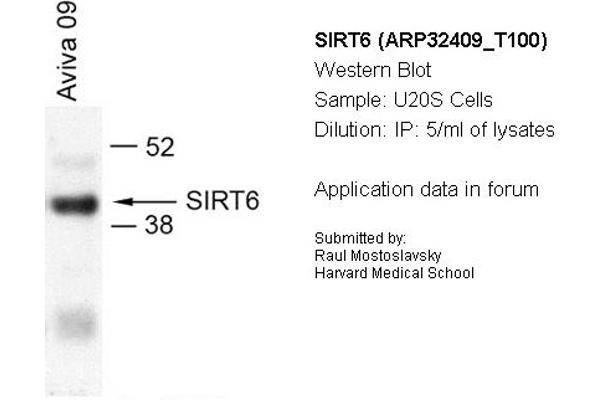 anti-Sirtuin 6 (SIRT6) (N-Term) antibody