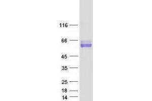 Image no. 1 for Synaptotagmin I (SYT1) (Transcript Variant 2) protein (Myc-DYKDDDDK Tag) (ABIN2733066)
