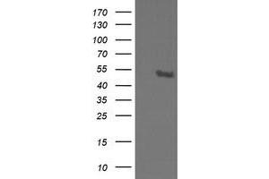 Image no. 6 for anti-serine/threonine Kinase 38 Like (STK38L) (AA 1-281) antibody (ABIN1490699)