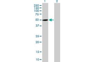 Image no. 2 for anti-PX domain-containing protein kinase-like protein (PXK) (AA 1-450) antibody (ABIN527240)