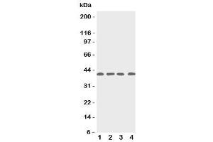 Western blot testing of p53R2 antbody