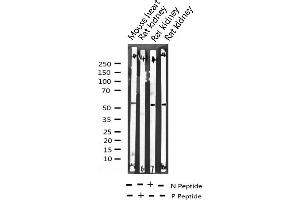 Image no. 1 for anti-Activating Transcription Factor 2 (ATF2) (pSer112), (pSer94) antibody (ABIN6256110)