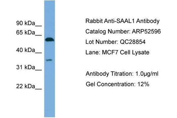 SAAL1 antibody  (N-Term)