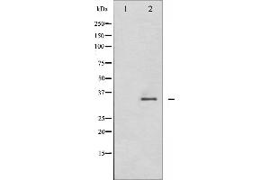 Image no. 2 for anti-Cyclin-Dependent Kinase 2 (CDK2) (pThr160) antibody (ABIN6255602)