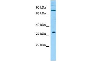 WB Suggested Anti-LOC100359836 Antibody Titration: 1.