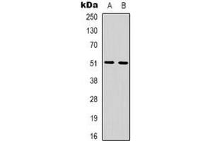 Image no. 3 for anti-Adrenergic, beta-1-, Receptor (ADRB1) antibody (ABIN2801400)
