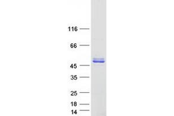 Proline Rich 5 (Renal) (PRR5) (Transcript Variant 2) protein (Myc-DYKDDDDK Tag)