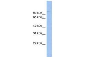 Image no. 1 for anti-ATP-Binding Cassette, Sub-Family B (MDR/TAP), Member 6 (ABCB6) (AA 431-480) antibody (ABIN6744718)