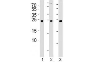 Image no. 1 for anti-Ubiquitin Carboxyl-terminal Esterase L3 (Ubiquitin Thiolesterase) (Uchl3) (AA 195-225) antibody (ABIN3029426)