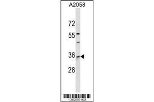 Image no. 1 for anti-RAB40A, Member RAS Oncogene Family (RAB40A) (AA 91-118) antibody (ABIN1538684)