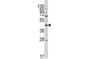 Image no. 2 for anti-Apolipoprotein A-V (APOA5) (AA 22-52) antibody (ABIN3028470)