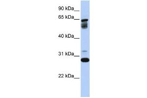 Image no. 1 for anti-Transmembrane Protein 187 (TMEM187) antibody (ABIN2458936)