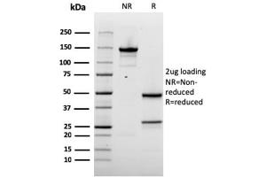 Image no. 1 for anti-Napsin A Aspartic Peptidase (NAPSA) (AA 189-299) antibody (ABIN6941164)