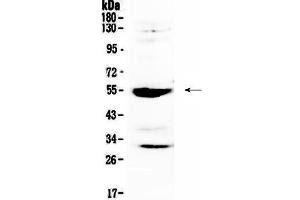 Image no. 1 for anti-Matrix Metallopeptidase 13 (Collagenase 3) (MMP13) (AA 99-335) antibody (ABIN5693125)