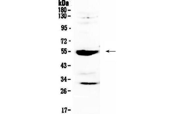 anti-Matrix Metallopeptidase 13 (Collagenase 3) (MMP13) (AA 99-335) antibody