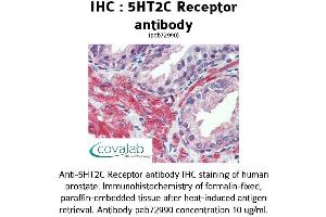 Image no. 2 for anti-5-Hydroxytryptamine (serotonin) Receptor 2C (HTR2C) (AA 387-446) antibody (ABIN1731368)